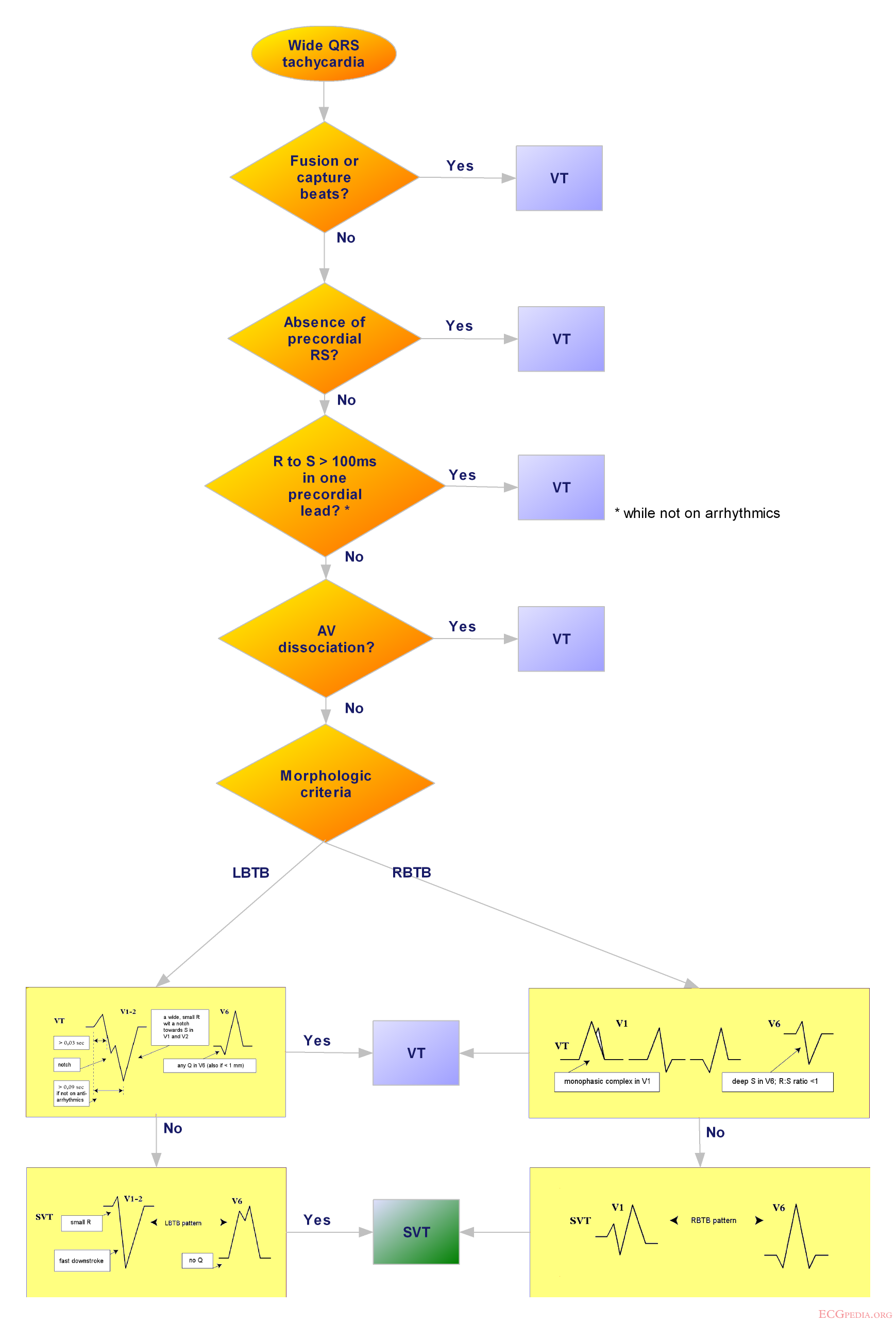 Flowchart of the approach to a wide complex tachycardia.