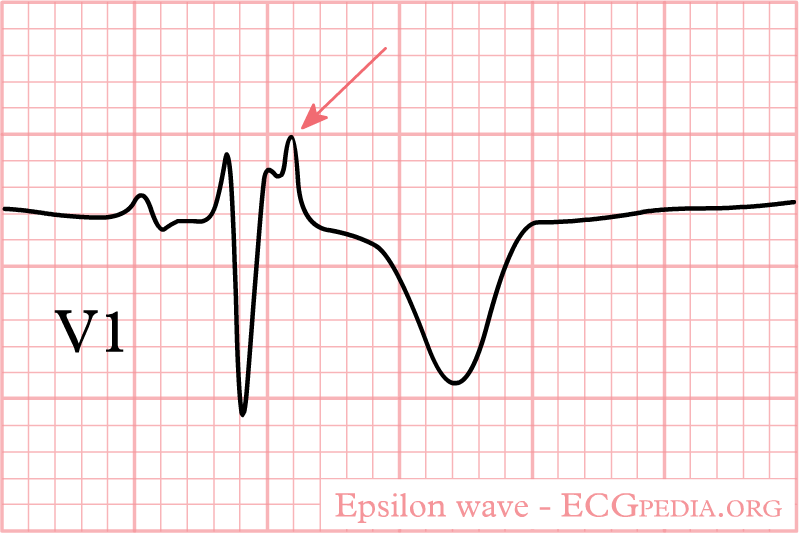 File:De-Epsilon wave.png