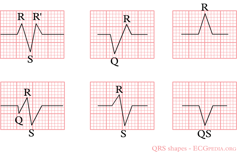 File:De-Qrs-shapes.png