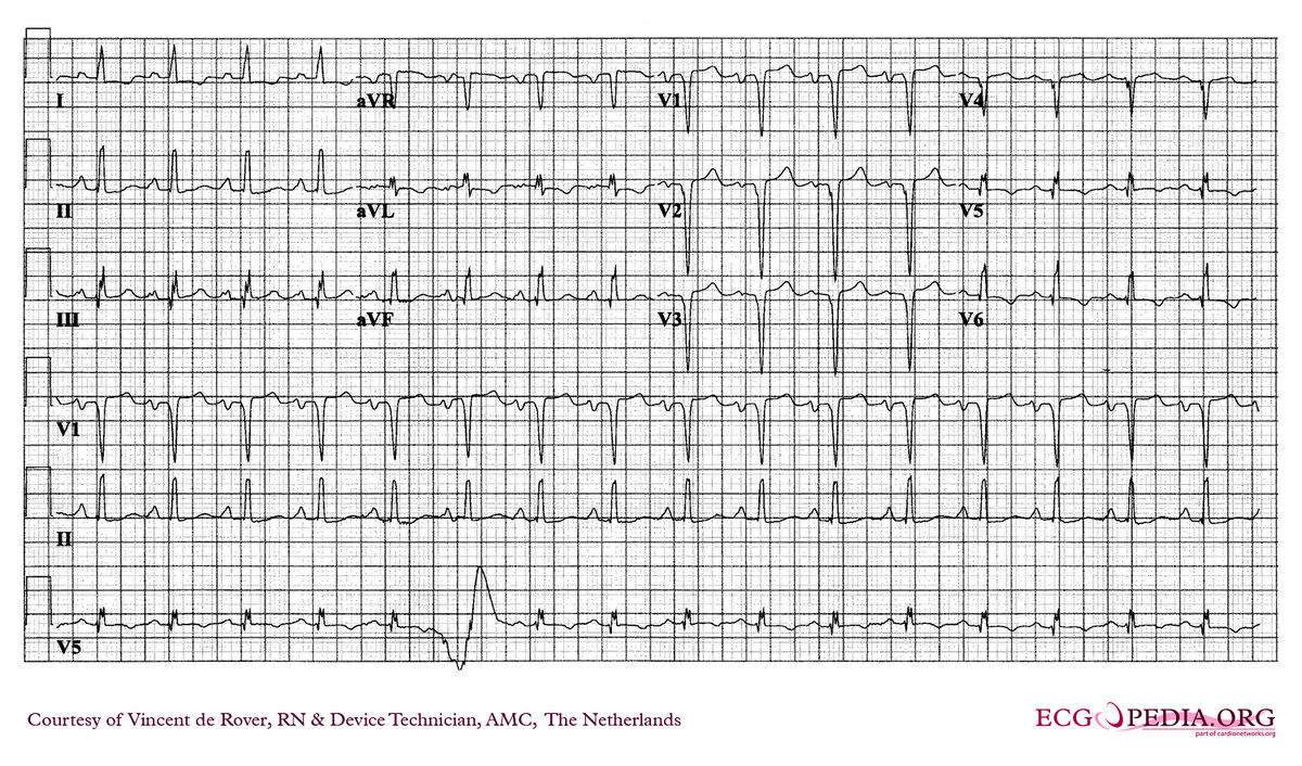 AMC Case 258 - ECGpedia