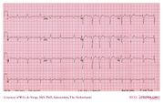 De Voogt ECG Archive - Cases - ECGpedia