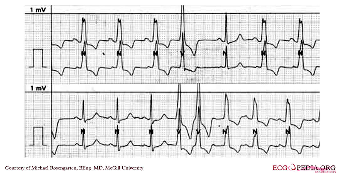 McGill Case 260 - ECGpedia