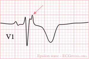 De-Epsilon wave.png