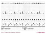 DVA-Part4 - ECGpedia