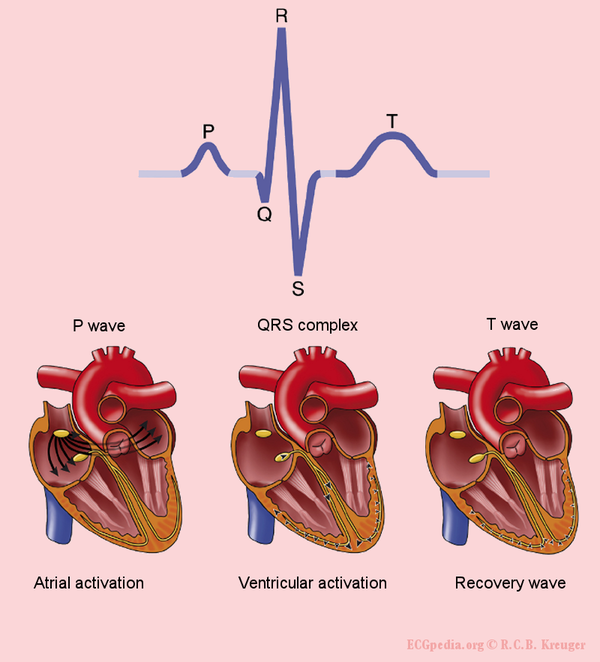 Test1 - ECGpedia