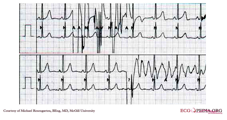 McGill Case 249 - ECGpedia