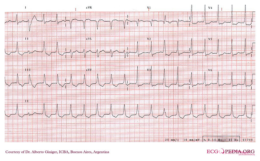 ICBA24 - ECGpedia