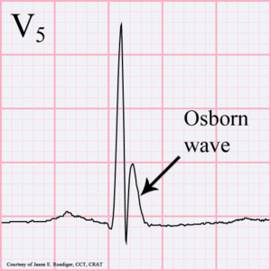 Osborn-wave.gif
