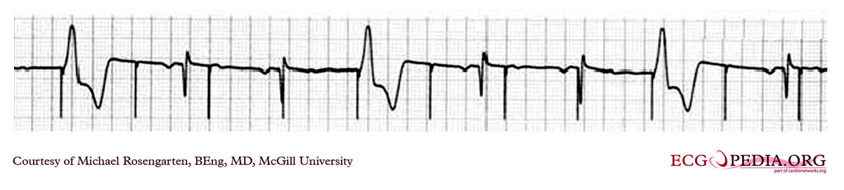 McGill Case 155 - ECGpedia