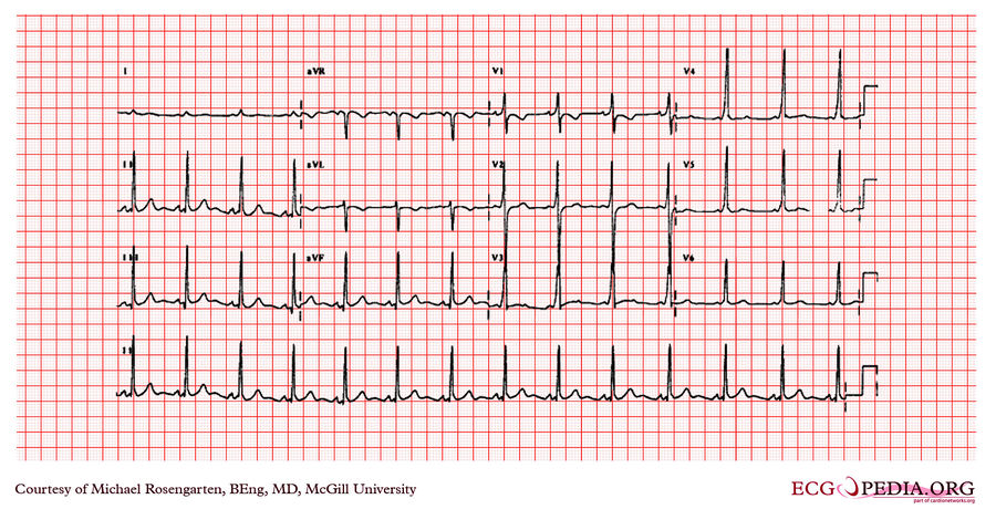 McGill Case 283 - ECGpedia