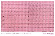 De Voogt ECG Archive - Cases - ECGpedia