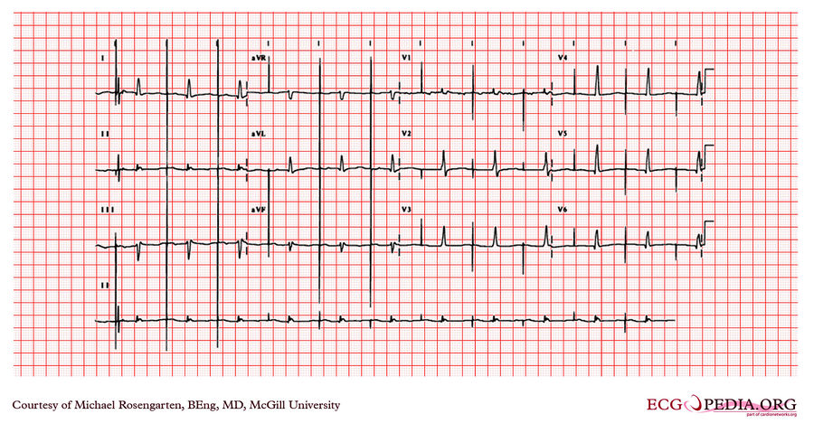 McGill Case 117 - ECGpedia