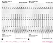 De Voogt ECG Archive - Cases - ECGpedia