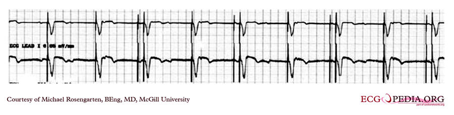 McGill Case 102 - ECGpedia