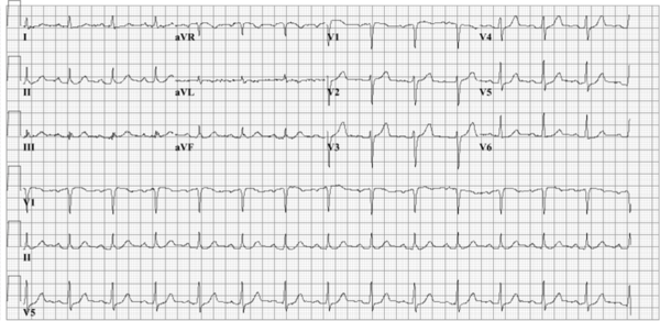 DRJ Case 2 - ECGpedia