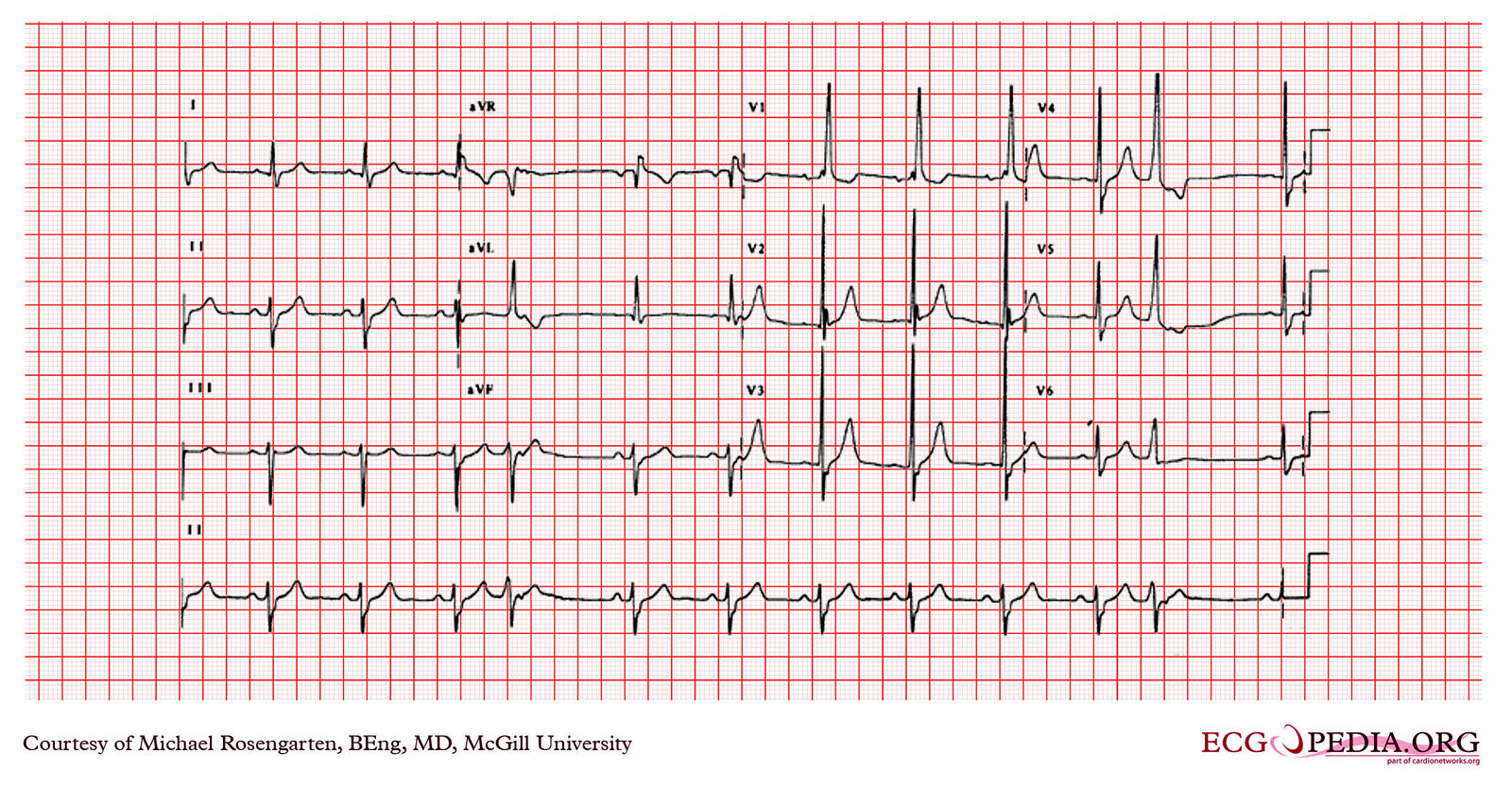 File:E261.jpg - ECGpedia