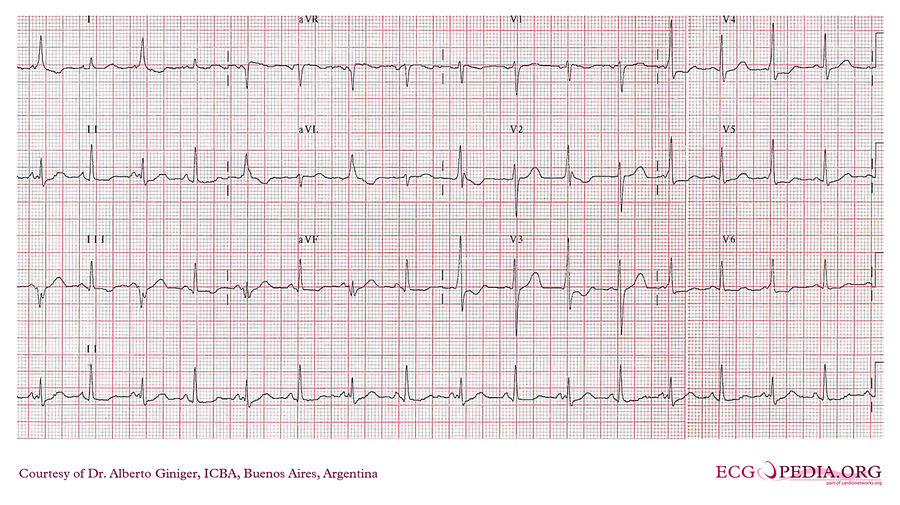 ICBA9 - ECGpedia