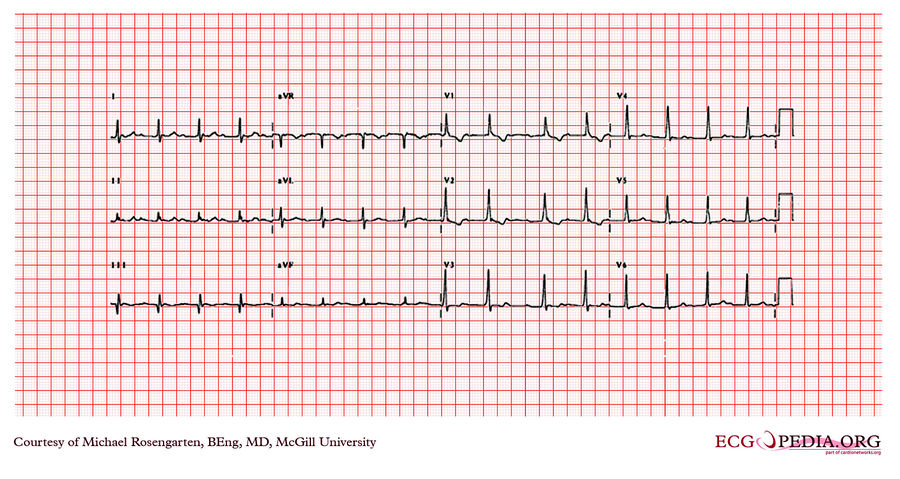 McGill Case 263 - ECGpedia