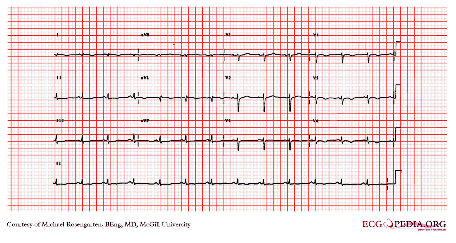 File:E268.jpg - ECGpedia