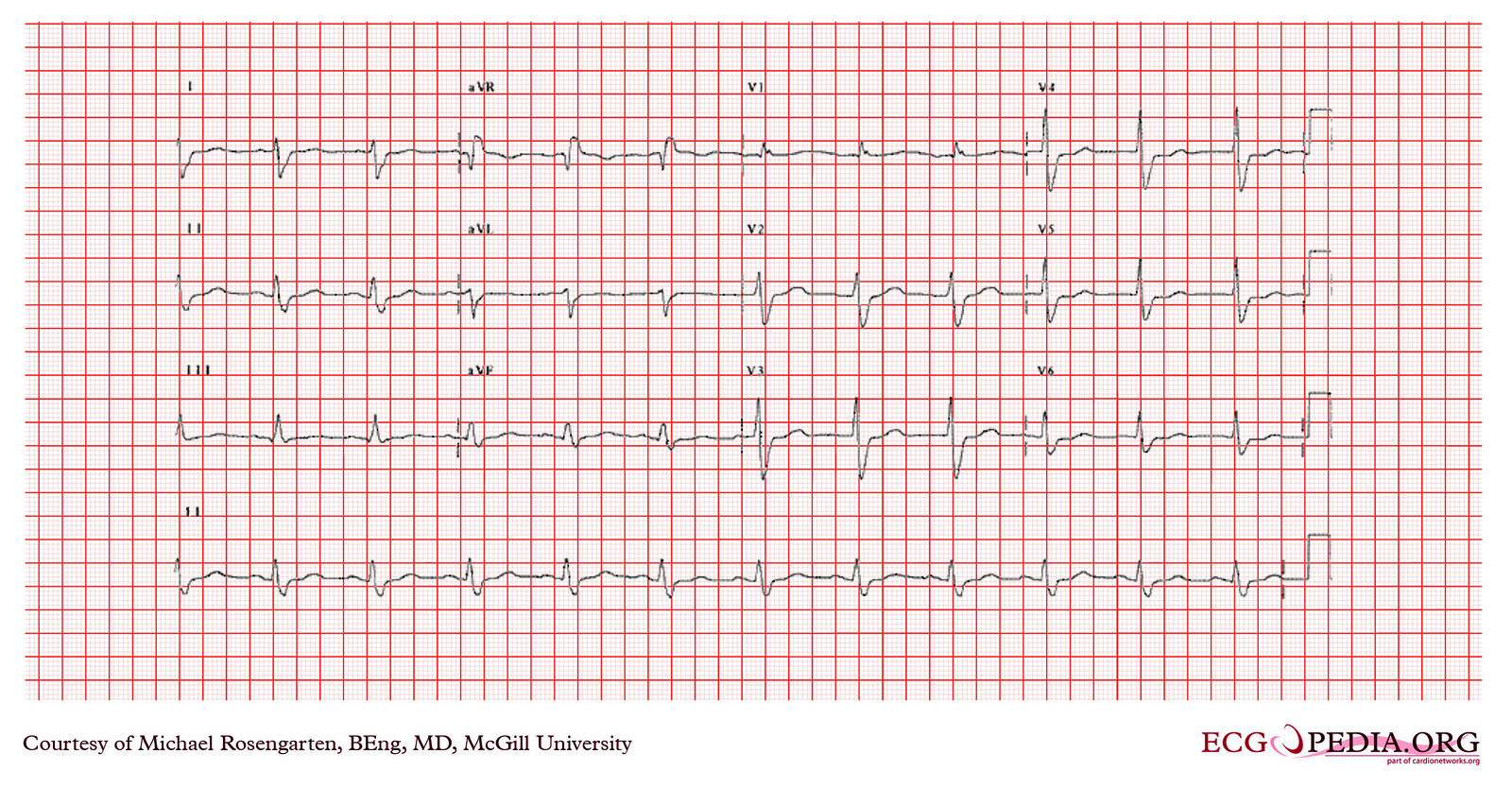 File:E364.jpg - ECGpedia