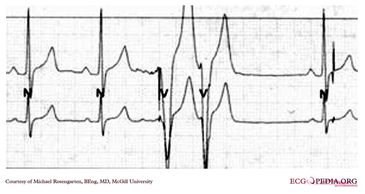 McGill Case 127 - ECGpedia