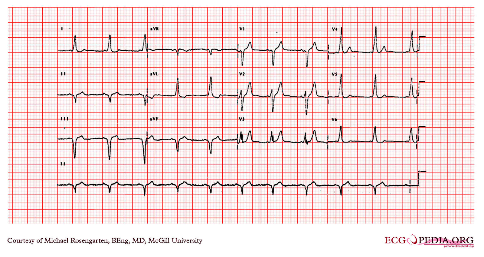 File:E204.jpg - ECGpedia