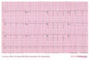 De Voogt ECG Archive - Cases - ECGpedia