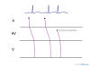 Ladder diagram.svg